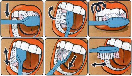 Уход за зубами. Как правильно чистит зубы?