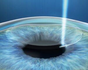 Лечение зрения в офтальмологической клинике Спектр