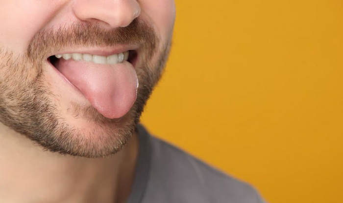 Новый ИИ способен поставить диагноз по виду языка с точностью 98% 