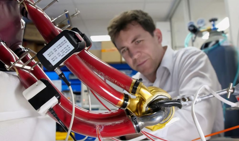 Человек впервые в мире прожил 100 дней с титановым сердцем и выписался из больницы 