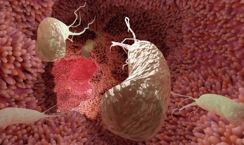 75% случаев рака желудка можно предотвратить с помощью простой профилактической меры 