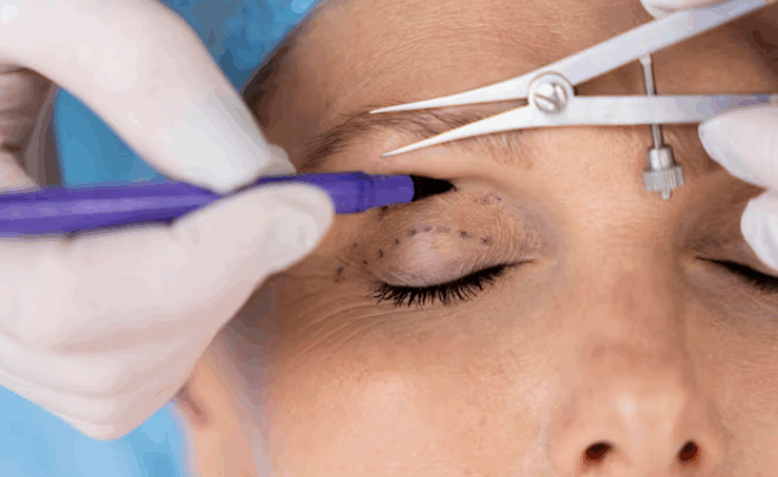 Рейтинг клиник Москвы для круговой блефаропластики