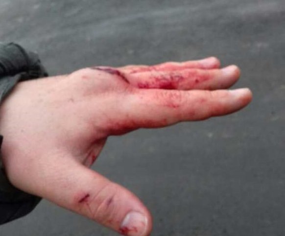 В Харькове избили «активиста» местного Евромайдана
